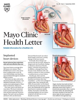 cover image of September 2025. Mayo Clinic Health Letter